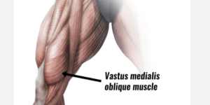 vmo muscle